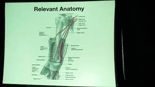 Anterior bridge plating FOR HUMERUS part 1 [upl. by Blaseio]