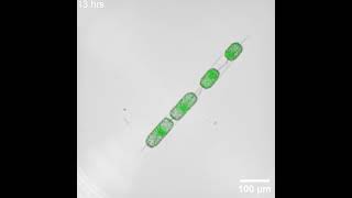 Diatom growth [upl. by Jessen]