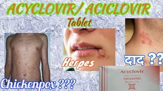 Acyclovir tablets  Herpikind  Herpikind Tablet  Zovirax  Zovirax tablets  uses side effects [upl. by Odnomar]