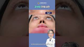 코성형과 콧볼축소 미국 유명 유튜버 실리아도 선택한 이곳은 👃복코 낮은코 200 성공법칙 [upl. by Asseralc]