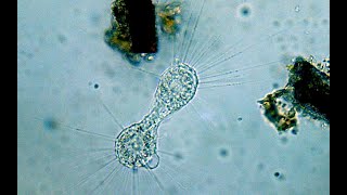 Heliozoan binary fission x20 speed [upl. by Neros]