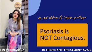 DR ARMEELA JAVAID TALKING ABOUT PSORIASIS AWARENESS [upl. by Bertsche]