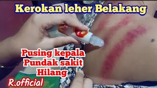 SCRAPING ✓KEROKAN LEHER BELAKANG SI NONA CANTIK [upl. by Levania723]