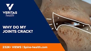 Why Do My Joints Crack [upl. by Sharla]