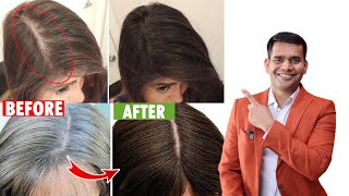 Stop Hair Fall And Reverse Premature Grey Hair Naturally  Dr Vivek Joshi [upl. by Nire15]