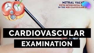 Cardiovascular Examination  OSCE Guide  UKMLA  CPSA [upl. by Gilberte]