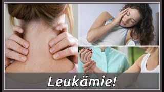 Das sind Symptome von Leukämie [upl. by Peppi]