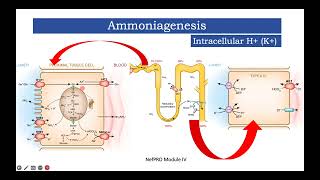 Module IV Approach to Hypokalemic Metabolic Alkalosis [upl. by Lion]