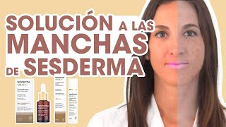 TRATAMIENTO ANTIMANCHAS Sesderma rostro libre de manchas solares I Al detalle [upl. by Idnew]