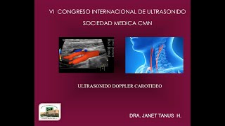 1  5 Ultrasonido Carotideo  Dra Tanus [upl. by Zobe]