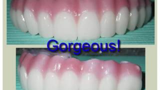 All on 4 Dental Implants and Zirconium Fixed Denture by Dr Bruce Kanehl [upl. by Hersch]