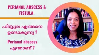 ഫിസ്റ്റുല amp Perianal abscess NO29By Dr Manju Kappen [upl. by Loggia]