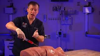 Emergency Pericardial Centesis Procedure Explained [upl. by Yorle]