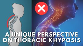 How To Fix The Root Cause Of Thoracic Kyphosis amp Upper Crossed Syndrome Hunchback Posture [upl. by Kovacs]