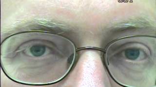 Nystagmus eye movement recording 1 [upl. by Enimsaj]