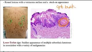 USMLE ACE Video 192 Skin Disorders Overview [upl. by Holey]