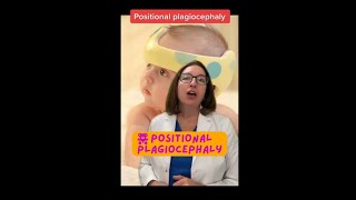 Positional Plagiocephaly Pediatrics SHORT  LevelUpRN [upl. by Philemol]