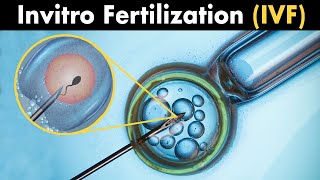 IVF PROCESS STEP BY STEP In Vitro Fertilisation Embryo cultivation [upl. by Arica]