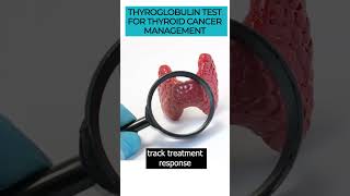 Discover the Thyroglobulin test amp its role in thyroid cancer detection and management thyroidcancer [upl. by Sheelagh]