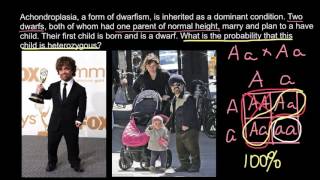 Peculiarities of Achondroplasia form of dwarfism Inheritance [upl. by Crispen]