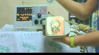 Defibrillator cardioversion [upl. by Na]