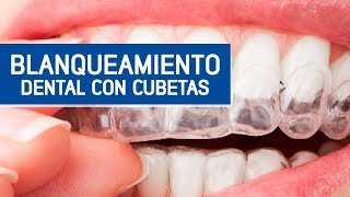 Blanqueamiento por cubetas  Odontoespecialistas [upl. by Dettmer835]