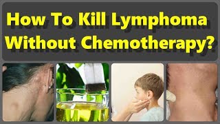 How To Kill Lymphoma Without Chemotherapy But With The Natural Remedies [upl. by Ramedlav4]