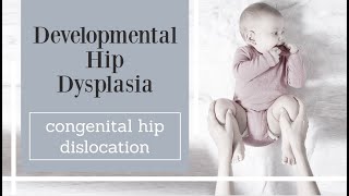 Developmental Hip Dysplasia  congenital hip dislocation [upl. by Natal757]