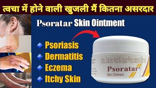 Psoratar Skin Ointment Uses For Psoriasis Treatment  Urea Salicylic Acid And Liquar Picis Carbonis [upl. by Aimahc]