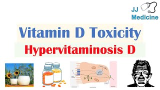 Vitamin D Toxicity Hypervitaminosis D  Causes Pathophysiology Symptoms Diagnosis Treatment [upl. by Eeryn]