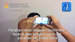 Scoliometer untuk iPhone dan Android  CARA PAKAI [upl. by Sherilyn]