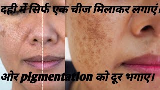 How to treat pigmentation at home  दही में सिर्फ एक चीज मिलाकर लगाएं।skincare ब्यूटी subscribe [upl. by Thaddus187]