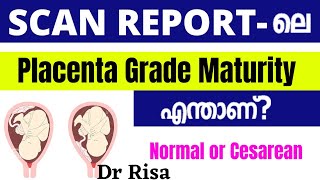 Placenta Grade in Scan Report Malayalam  Placenta Position [upl. by Anifares]