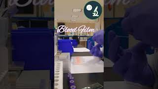 Peripheral Blood Smear [upl. by Havelock]