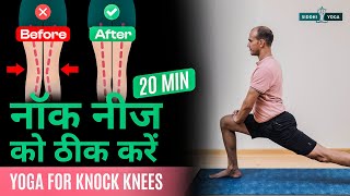 20 Min Yoga for Knock Knees in Hindi नॉक नीज की समस्या को ठीक करने के लिए योग Knock Knees Correction [upl. by Reeves]