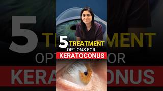 5 Treatment Options For Keratoconus [upl. by Nelra]