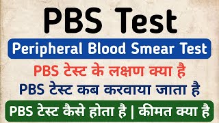 PBS Test in hindi  Peripheral Blood Smear Test in hindi  Symptoms amp Cost of PBS Test [upl. by Noramac646]