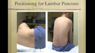 Lumbar Puncture [upl. by Hestia538]