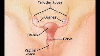 How to Treat Gonorrhea [upl. by Ainotal]