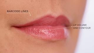 Fillerina Specific Zones with 3D Collagen [upl. by Gnov]