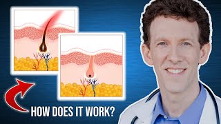 How Does Laser Hair Removal Work [upl. by Curtis964]