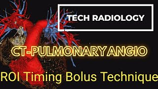 PULMONARY ANGIOGRAPHY CTPRESSURE INJECTING CONTRASTROITIME BOLUS😍 [upl. by Ehav]