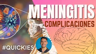 Meningitis Diagnóstico del Líquido Cefalorraquídeo Bacterias vs Virus vs Hongos [upl. by Latreese878]