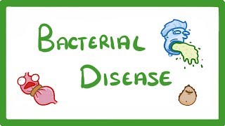 GCSE Biology  What Are Bacterial Diseases  Treatment and Prevention 37 [upl. by Amrita646]