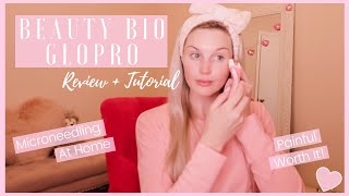 BEAUTY BIO GLOPRO Review  Tutorial  Painful Worth It [upl. by Kristyn420]