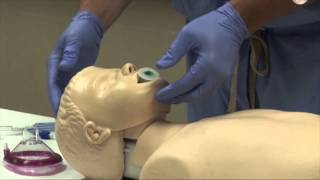 Airway Management [upl. by Gratiana]