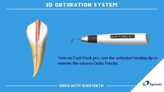 How to Use Eighteeth Obturation System FastPack FastFill Continuous Wave Compaction WVC [upl. by Eikcor]