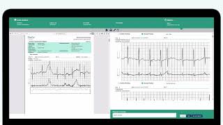 Introducing Enhanced ECG [upl. by Vandyke]