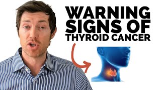 Thyroid Cancer Symptoms amp Early Warning Signs [upl. by Niwrehs386]