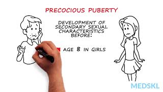 Pediatrics – Abnormal Pubertal Development By Paola Luca MD [upl. by Analise989]